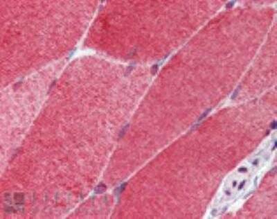 Immunohistochemistry-Paraffin: HSF1 Antibody (10H8) [NBP1-97504]