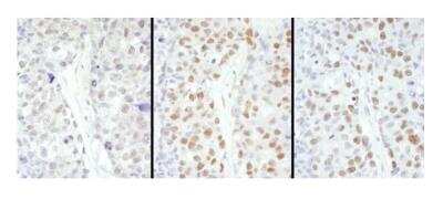 Immunohistochemistry-Paraffin: HSF1 Antibody [NBP1-71931]