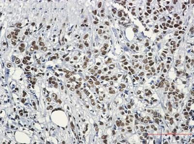 Immunohistochemistry-Paraffin: HSF1 Antibody (S07-0G0) [NBP3-14895]