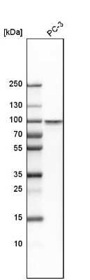 Western Blot: HSF1 Antibody [NBP1-81665]