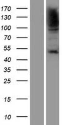 Western Blot: HSF1 Overexpression Lysate [NBP2-07736]