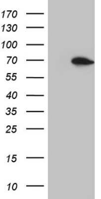 Western Blot: HSF2 Antibody (OTI3E1) [NBP2-46007]