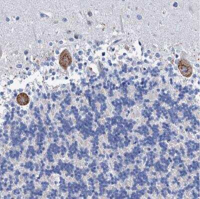 Immunohistochemistry-Paraffin: HSF2 Antibody [NBP1-86330]