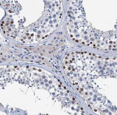 Immunohistochemistry-Paraffin: HSF2 Antibody [NBP1-86330]