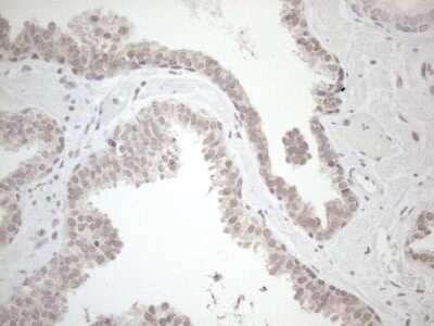 Immunohistochemistry: HSF2 Antibody (OTI3E1) - Azide and BSA Free [NBP2-70948]