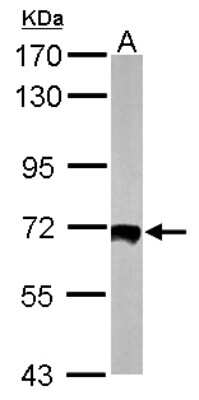 Western Blot: HSF2 Antibody [NBP2-16886]