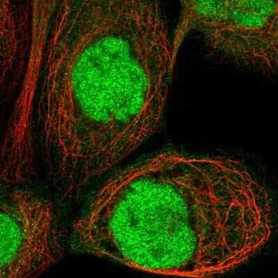 Immunocytochemistry/ Immunofluorescence: HSF2BP Antibody [NBP1-86325]