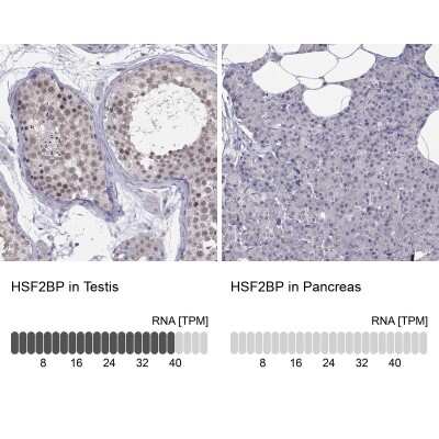 Immunocytochemistry/ Immunofluorescence: HSF2BP Antibody [NBP3-17056]