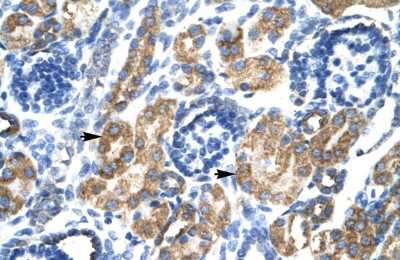 Immunohistochemistry: HSF2BP Antibody [NBP2-87607]