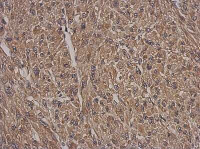 Immunohistochemistry-Paraffin: HSF2BP Antibody [NBP2-16887]