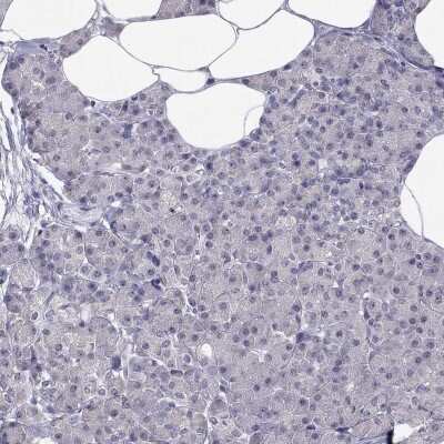 Immunohistochemistry-Paraffin: HSF2BP Antibody [NBP3-17056]