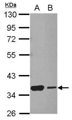 Western Blot: HSF2BP Antibody [NBP2-16887]