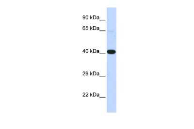 Western Blot: HSF2BP Antibody [NBP2-87608]