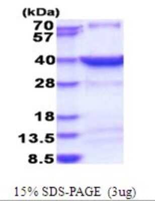 SDS-PAGE: Recombinant Human HSF2BP His Protein [NBP2-51797]