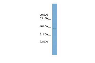 Western Blot: HSF3 Antibody [NBP3-09206]