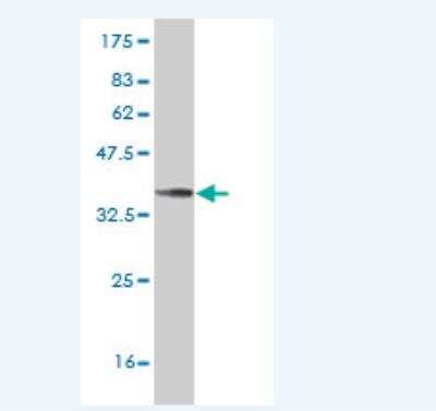 Western Blot: HSF4 Antibody (2A2) [H00003299-M04]