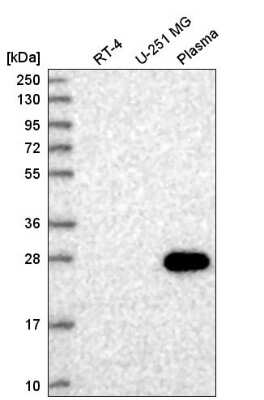 Western Blot: HSF4 Antibody [NBP2-58258]