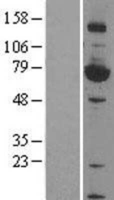 Western Blot: HSF4 Overexpression Lysate [NBP2-04190]