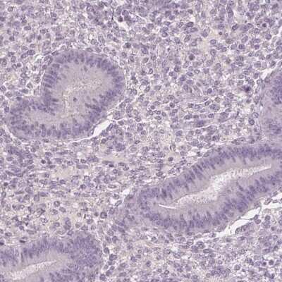 Immunohistochemistry-Paraffin: HSF5 Antibody [NBP2-49401]