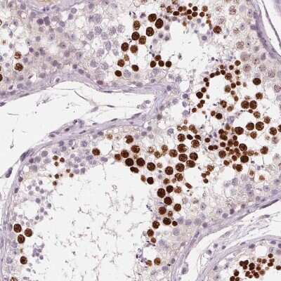 Immunohistochemistry-Paraffin: HSF5 Antibody [NBP2-49401]