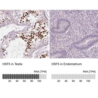 Immunohistochemistry-Paraffin: HSF5 Antibody [NBP2-49401]