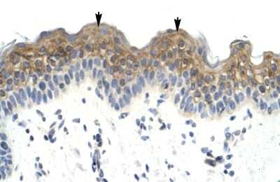 Immunohistochemistry: HSFX1/2 Antibody [NBP3-10379]