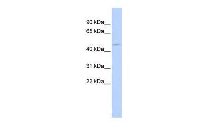 Western Blot: HSFX1/2 Antibody [NBP3-10380]