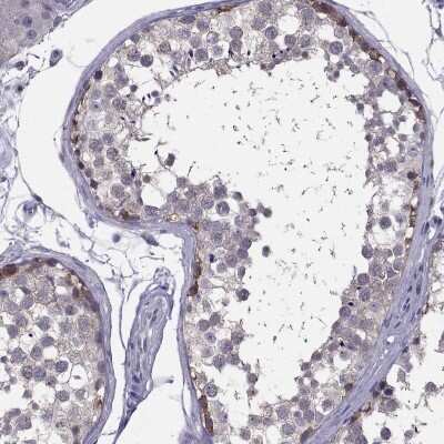 Immunocytochemistry/ Immunofluorescence: HSFX2 Antibody [NBP2-68801]