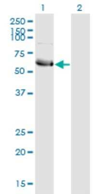 Western Blot: HSFY1 Antibody (1D2) [H00086614-M10]