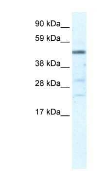 Western Blot: HSFY1 Antibody [NBP1-80129]