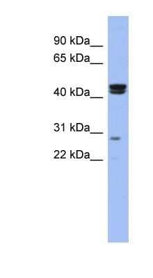 Western Blot: HSFY1 Antibody [NBP1-80387]