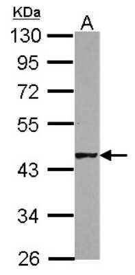 Western Blot: HSFY1 Antibody [NBP2-16888]