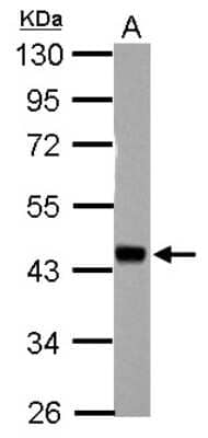 Western Blot: HSFY1 Antibody [NBP2-16888]