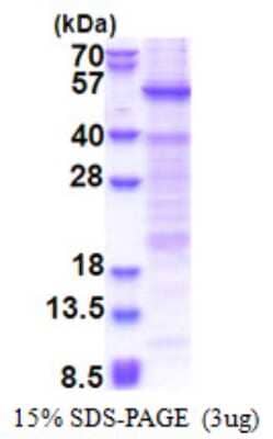 SDS-PAGE: Recombinant Human HSFY1 His Protein [NBP2-23105]