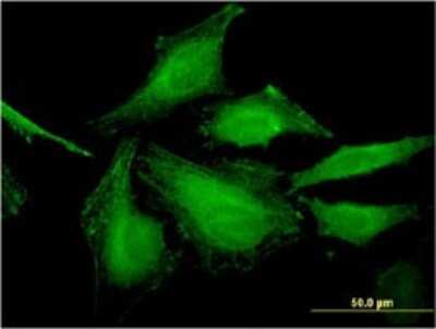 Immunocytochemistry/ Immunofluorescence: HSFY2 Antibody (4B7) [H00159119-M02]