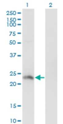 Western Blot: HSFY2 Antibody (4B7) [H00159119-M02]