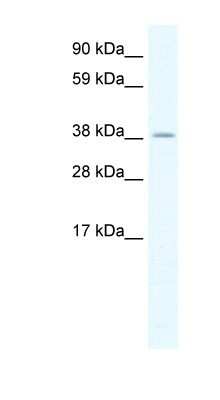 Western Blot: HSFY2 Antibody [NBP1-80247]