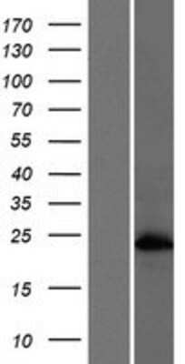 Western Blot: HSFY2 Overexpression Lysate [NBP2-08961]