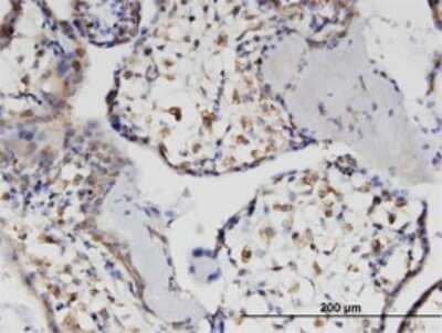 Immunohistochemistry-Paraffin: HSH2D Antibody (1D6) [H00084941-M01]