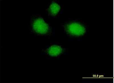 Immunocytochemistry/ Immunofluorescence: HSH2D Antibody [H00084941-B01P]