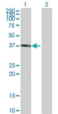 Western Blot: HSH2D Antibody [H00084941-B02P]