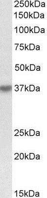 Western Blot: HSH2D Antibody [NBP1-52023]