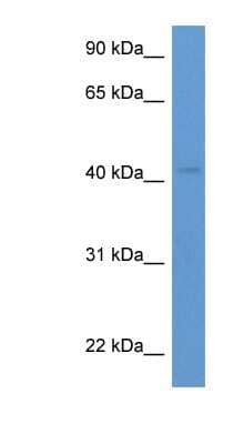 Western Blot: HSH2D Antibody [NBP1-79862]