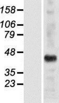 Western Blot: HSH2D Overexpression Lysate [NBP2-05959]