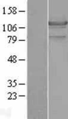 Western Blot: Hormone-sensitive Lipase/HSL Overexpression Lysate [NBL1-12548]