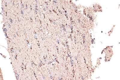 Immunohistochemistry-Paraffin: HSP10/EPF Antibody (0H0X6) [NBP3-16604]