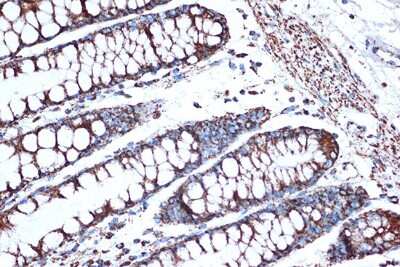 Immunohistochemistry-Paraffin: HSP10/EPF Antibody (0H0X6) [NBP3-16604]