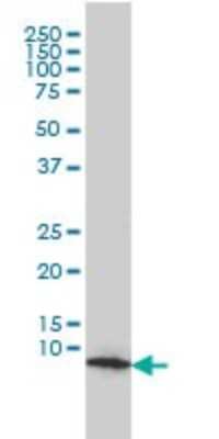 Western Blot: HSP10/EPF Antibody (4C11-B11) [H00003336-M01]