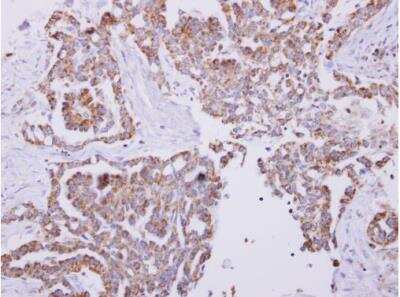 Immunohistochemistry-Paraffin: HSP10/EPF Antibody [NBP2-16890]