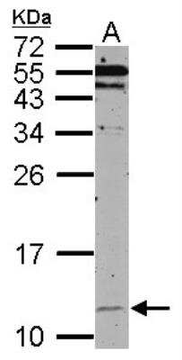 Western Blot: HSP10/EPF Antibody [NBP2-16889]